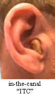 ear3